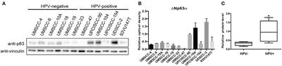 Human Papilloma Virus Increases ΔNp63α Expression in Head and Neck Squamous Cell Carcinoma